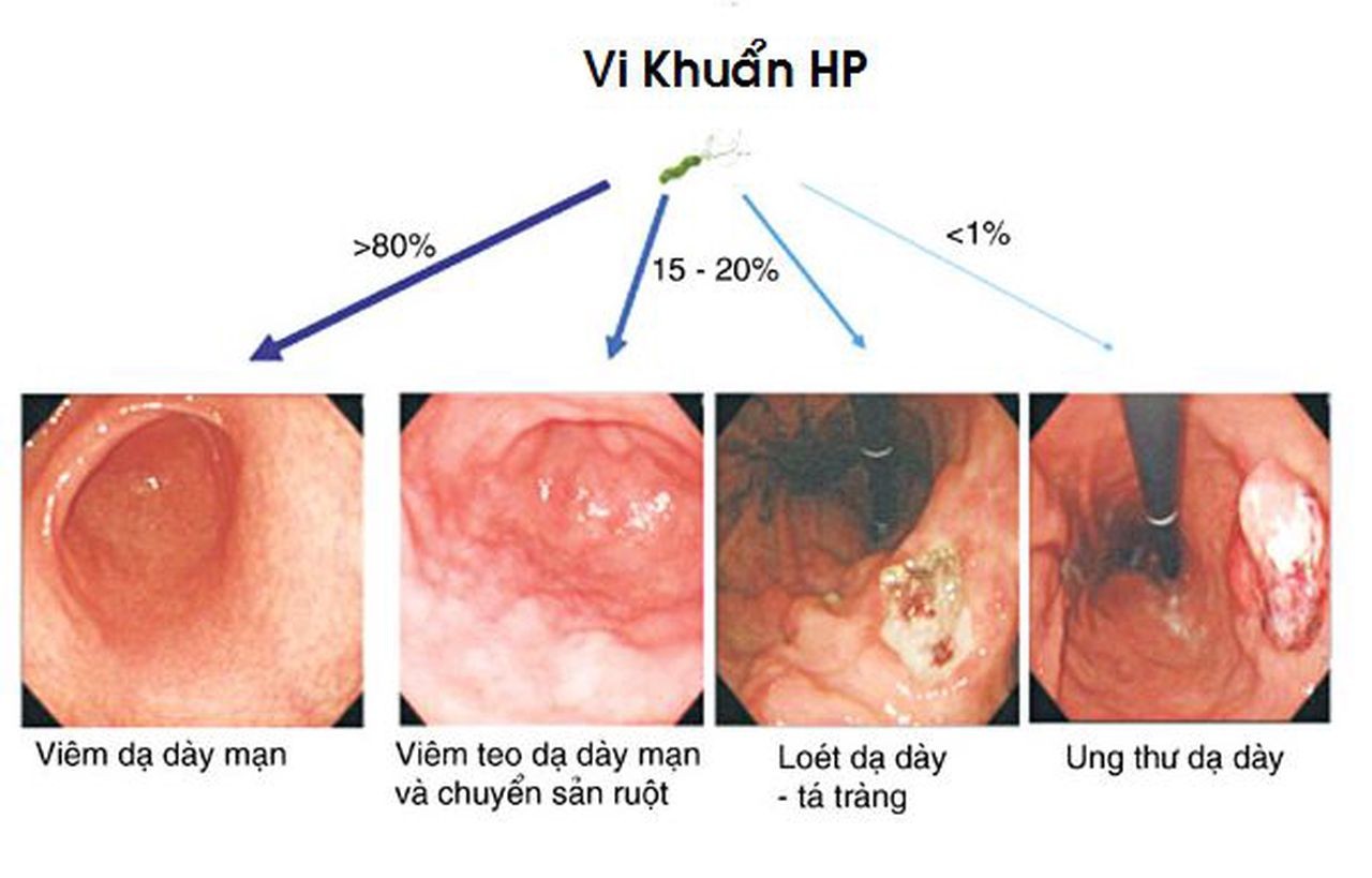 Bảo hiểm sức khỏe là gì?